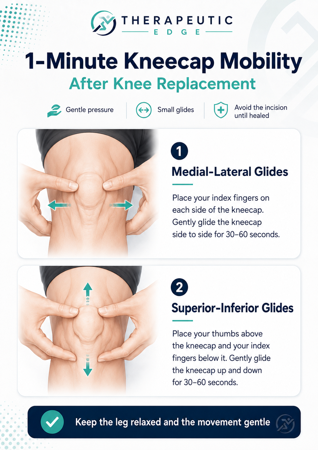 Kneecap mobility after total knee replacement infographic showing side-to-side and up-and-down patellar glides